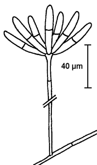 Konidienträger von Arthrobotrys dactyloides